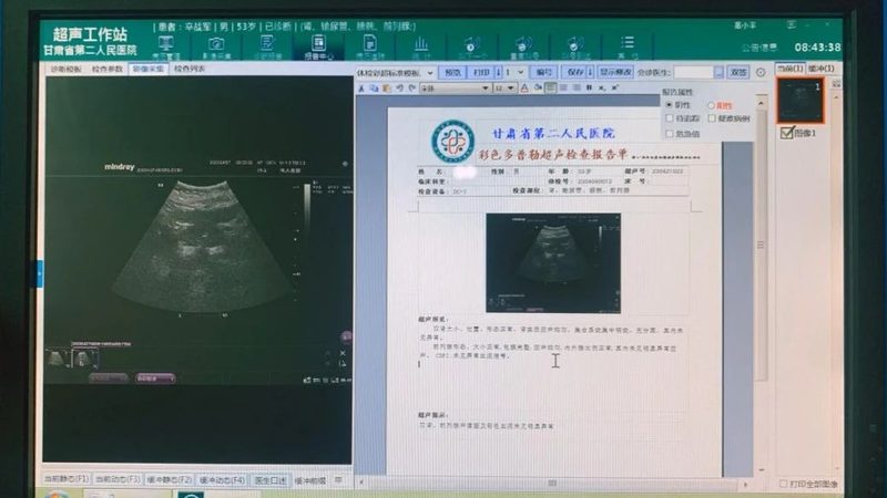 北京孕前检查项目全解析
